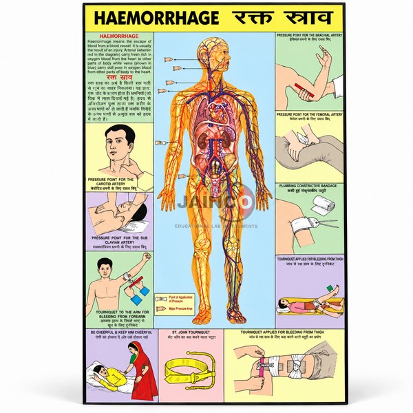 Hemorrhage Chart